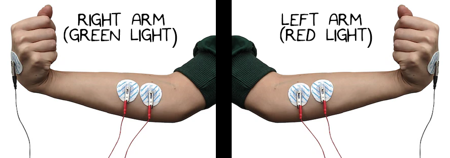 Electrode Check