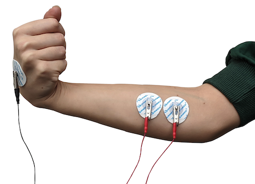 Electrode Placement