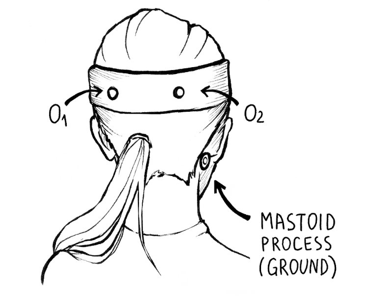 Occipital EEG Recording