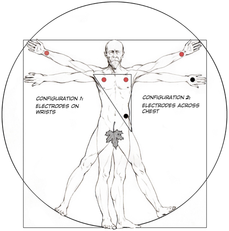 Procedure