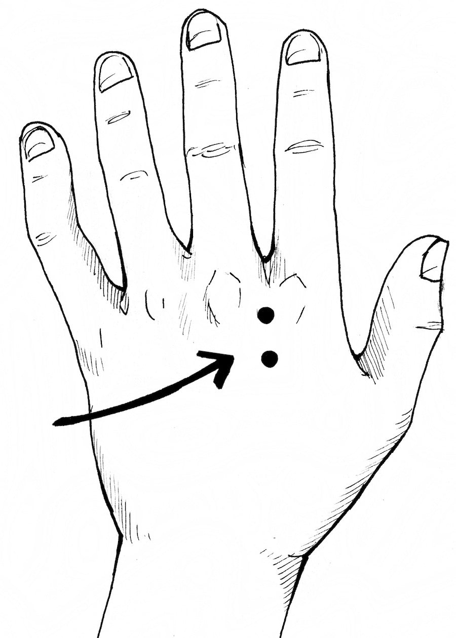 Electrode Placement: