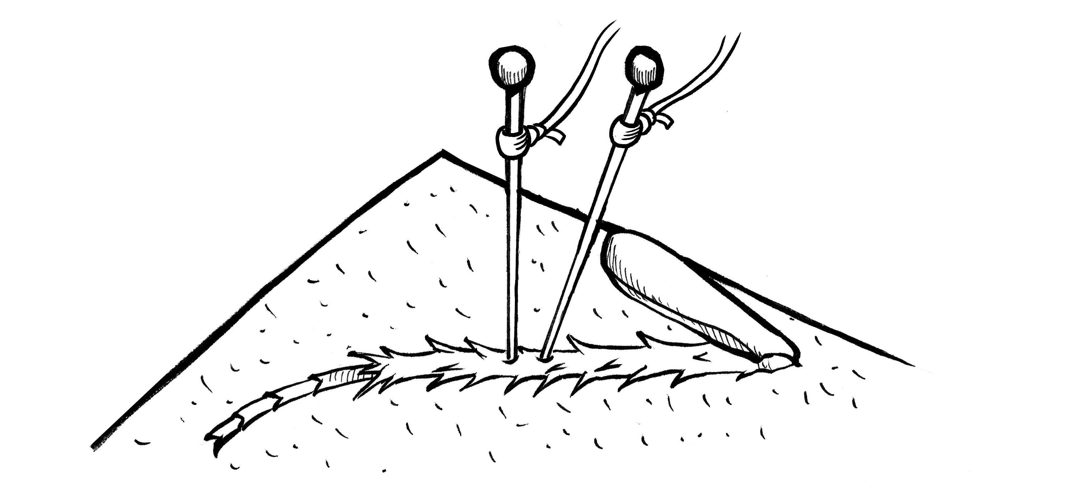 Electrode Placement: