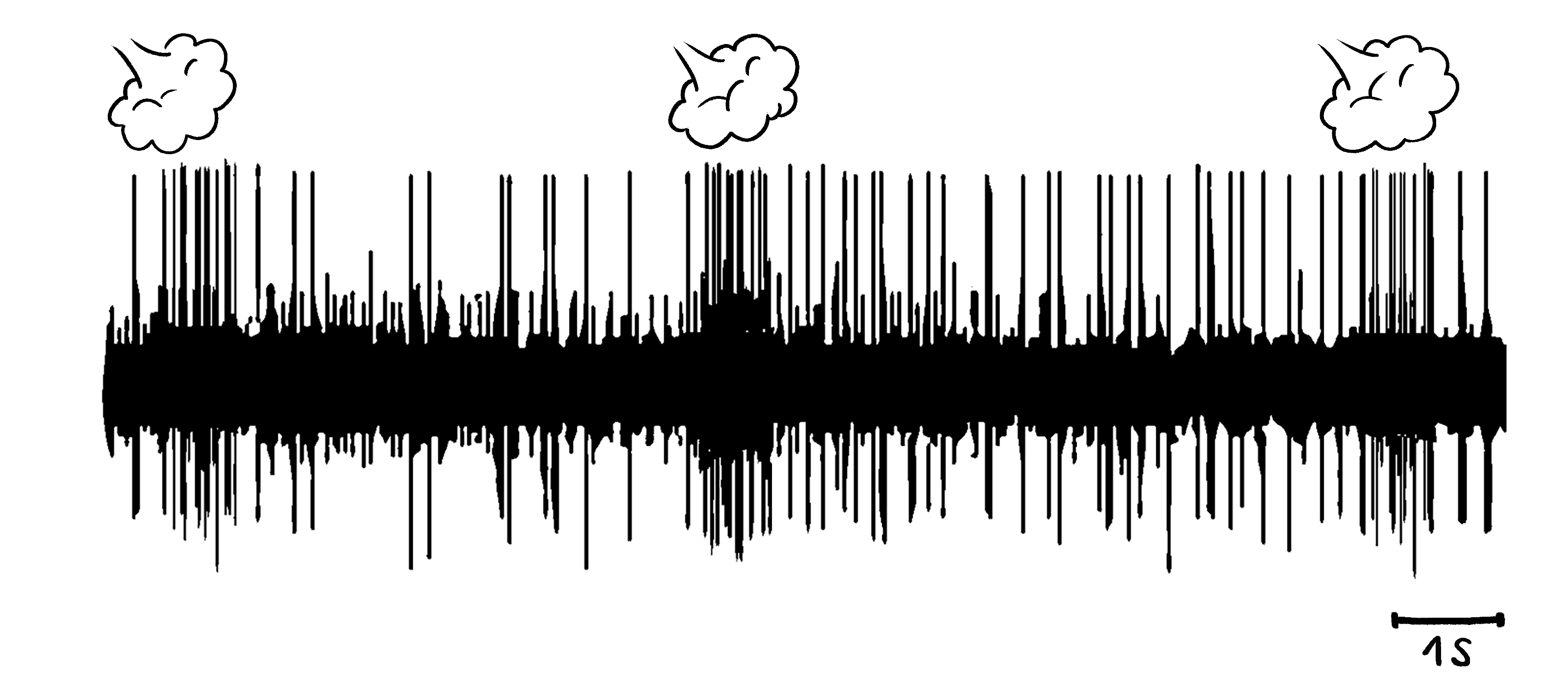 Baseline Recording: